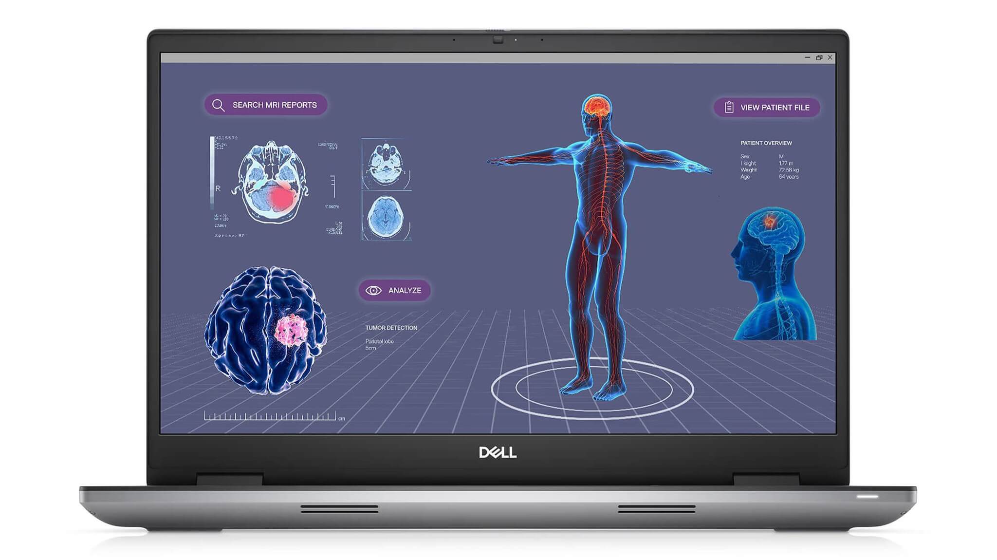 DELL Precision 7780 (2023) - Workstation Hiệu Năng Cao - Thiết kế bền bỉ chuẩn